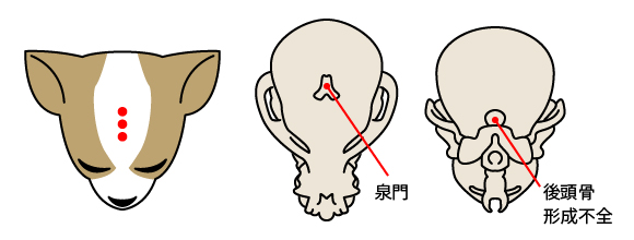 大泉門開存（ペコ）