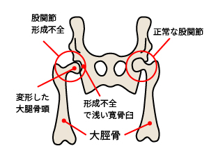 股関節形成不全