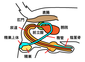 陰睾丸 (停留睾丸）